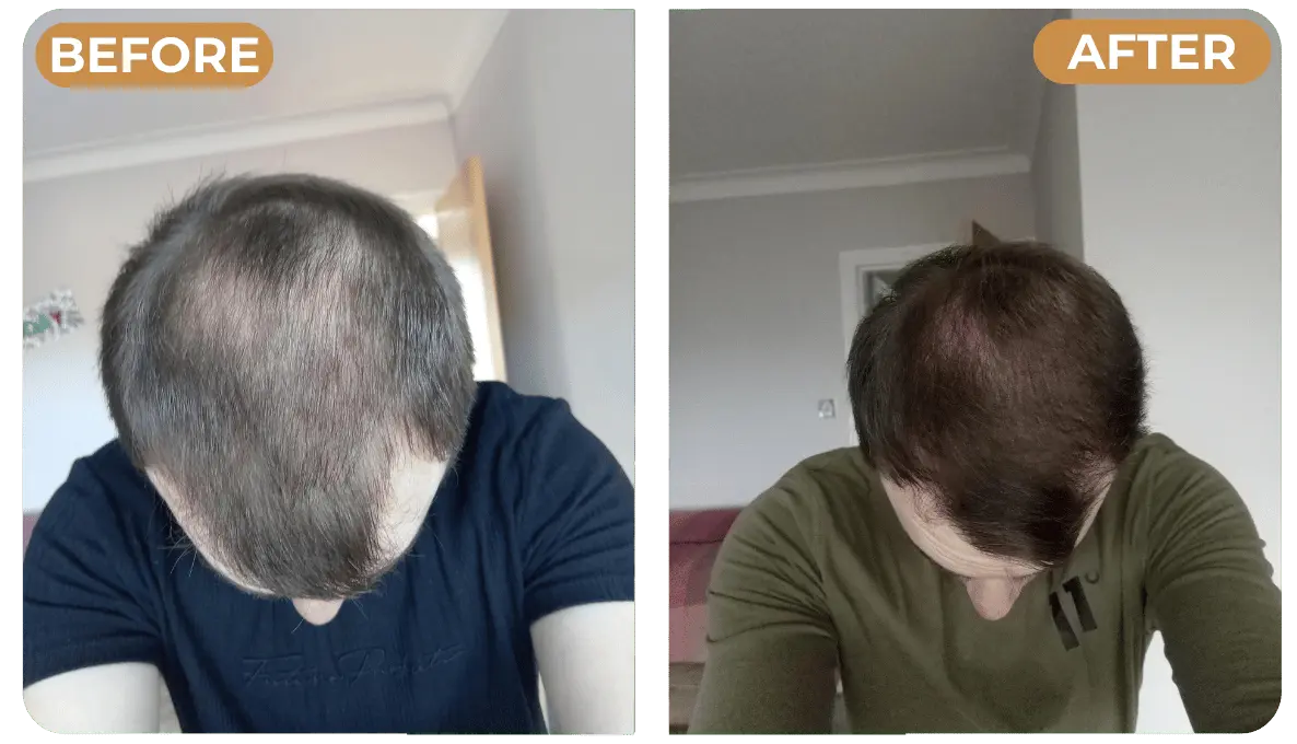 Applying Spartan Root Activator Shampoo to men's hair and scalp