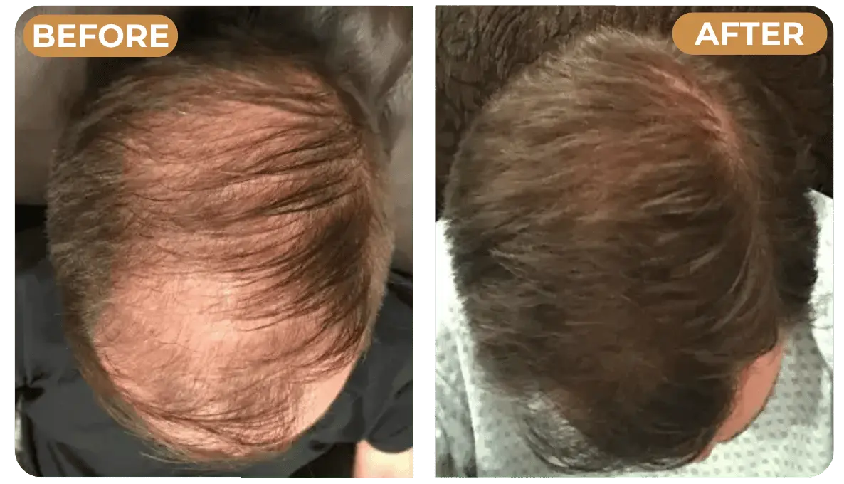Rinsing Spartan Root Activator Shampoo after use